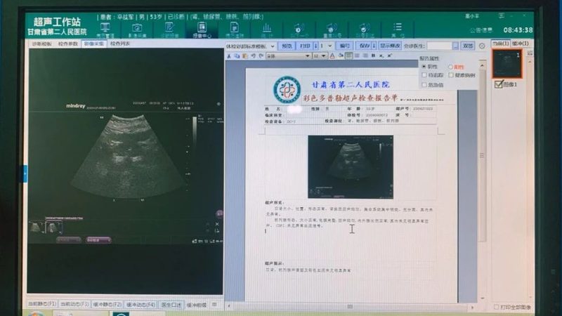 孕前体检费用明细表别只看总价